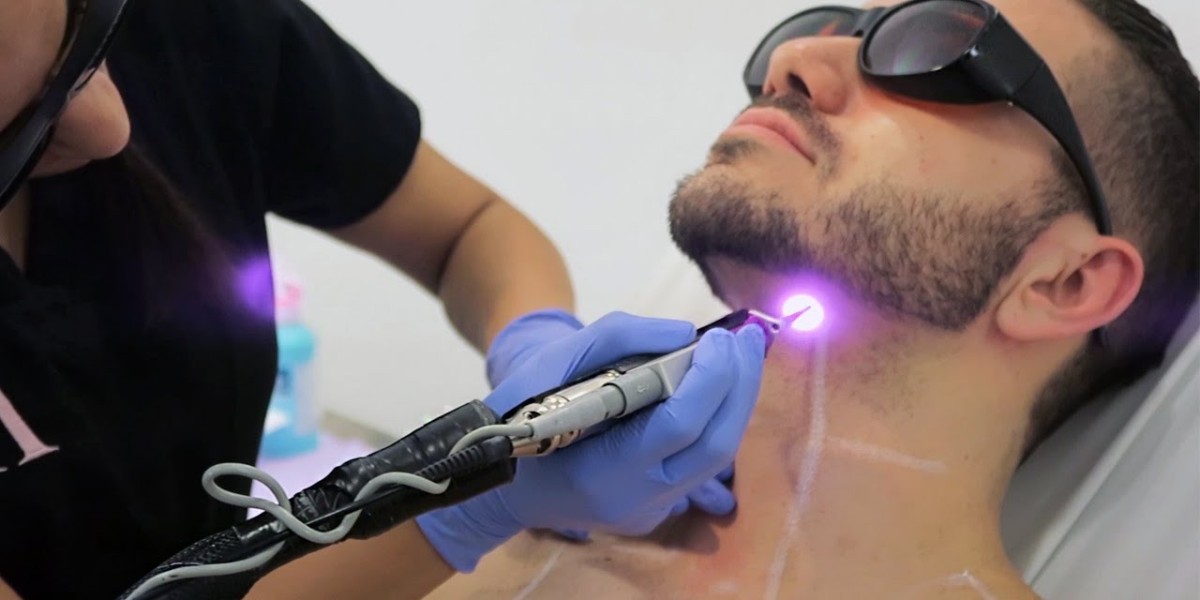 Full body laser hair removal cost